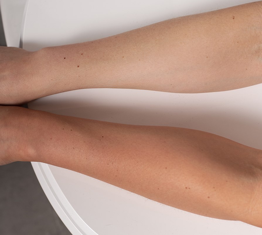 Brun utan sol spraytan fre och efter.