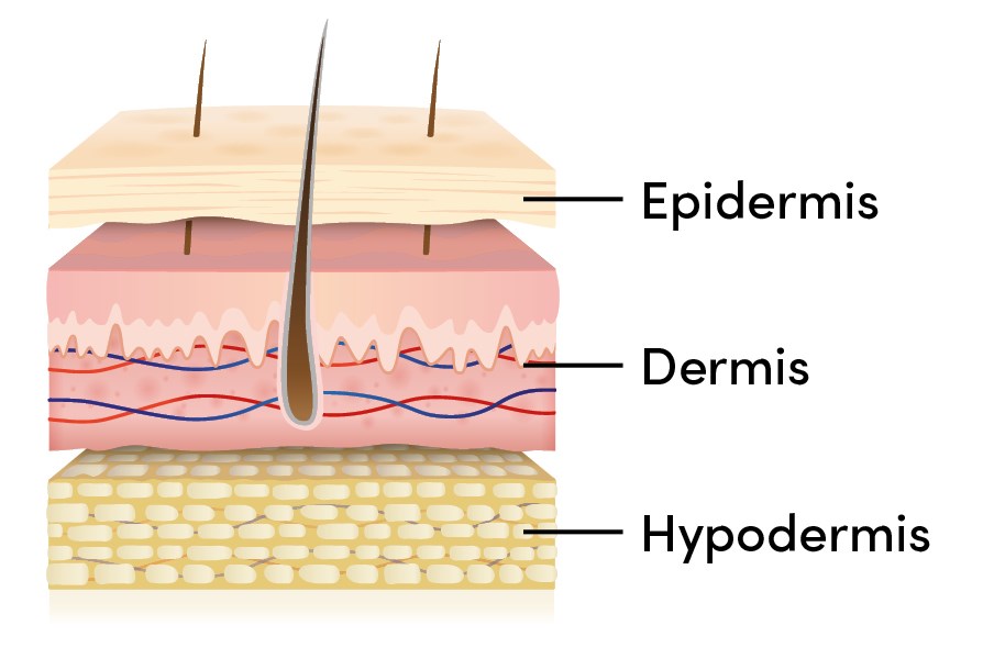 Bild på hudens tre lager, epidermis, dermis och hypodermis.