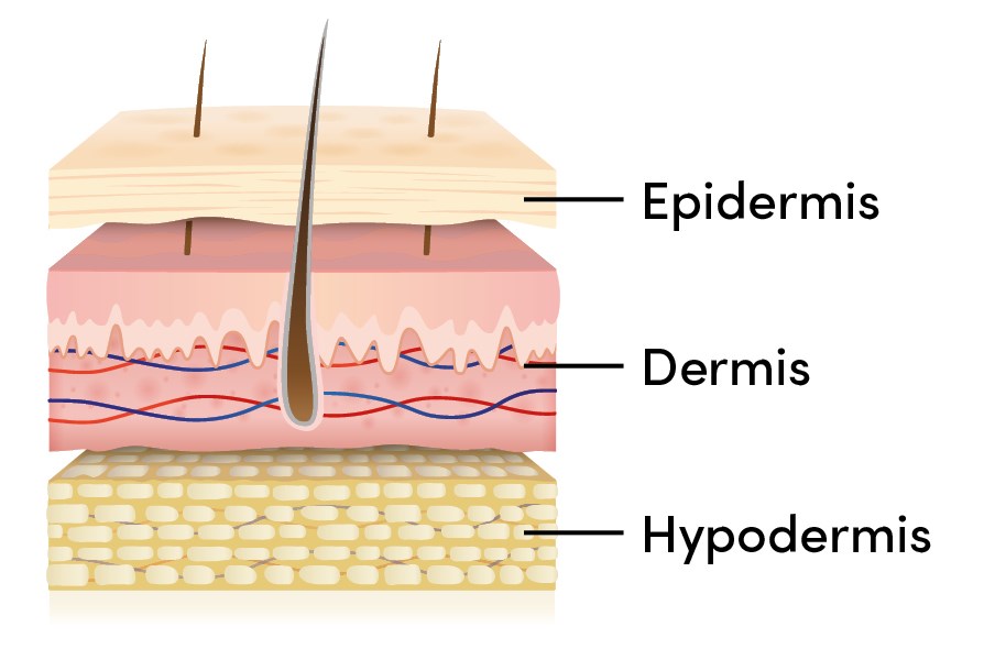 Bild p hudens tre lager, epidermis, dermis och hypodermis.