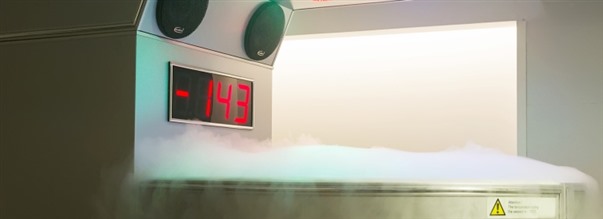 Kan kyla ka din prestation?