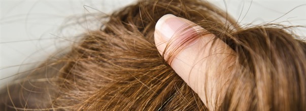 Det hr r sknhetstillskottet selen bra fr