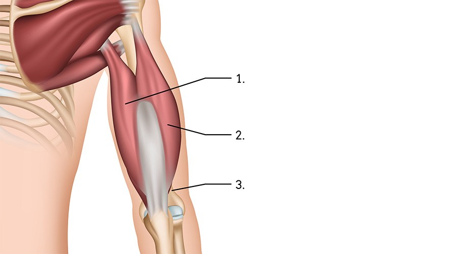 Illustration p� triceps brachialis.